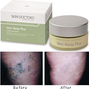 Vein Away Spider Vein Remover (100g)